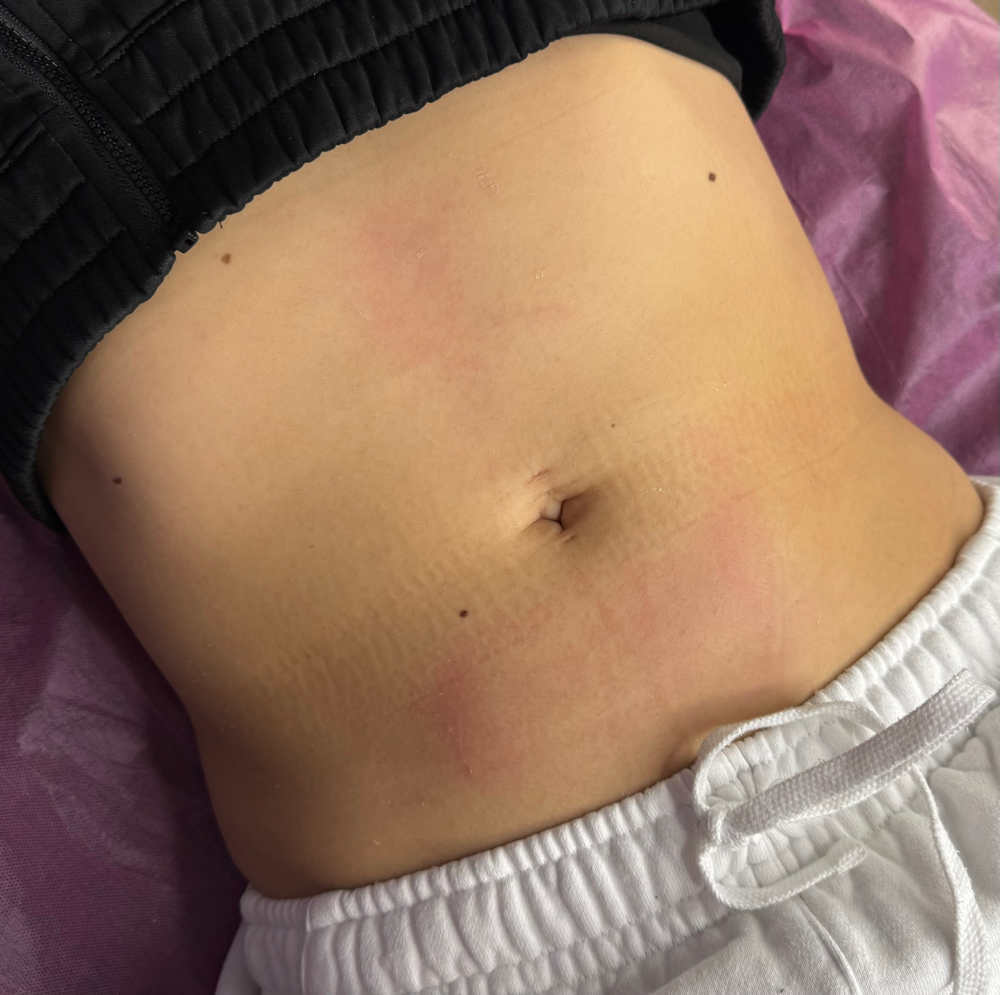 Stomach Wax