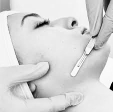 Dermaplane Facial