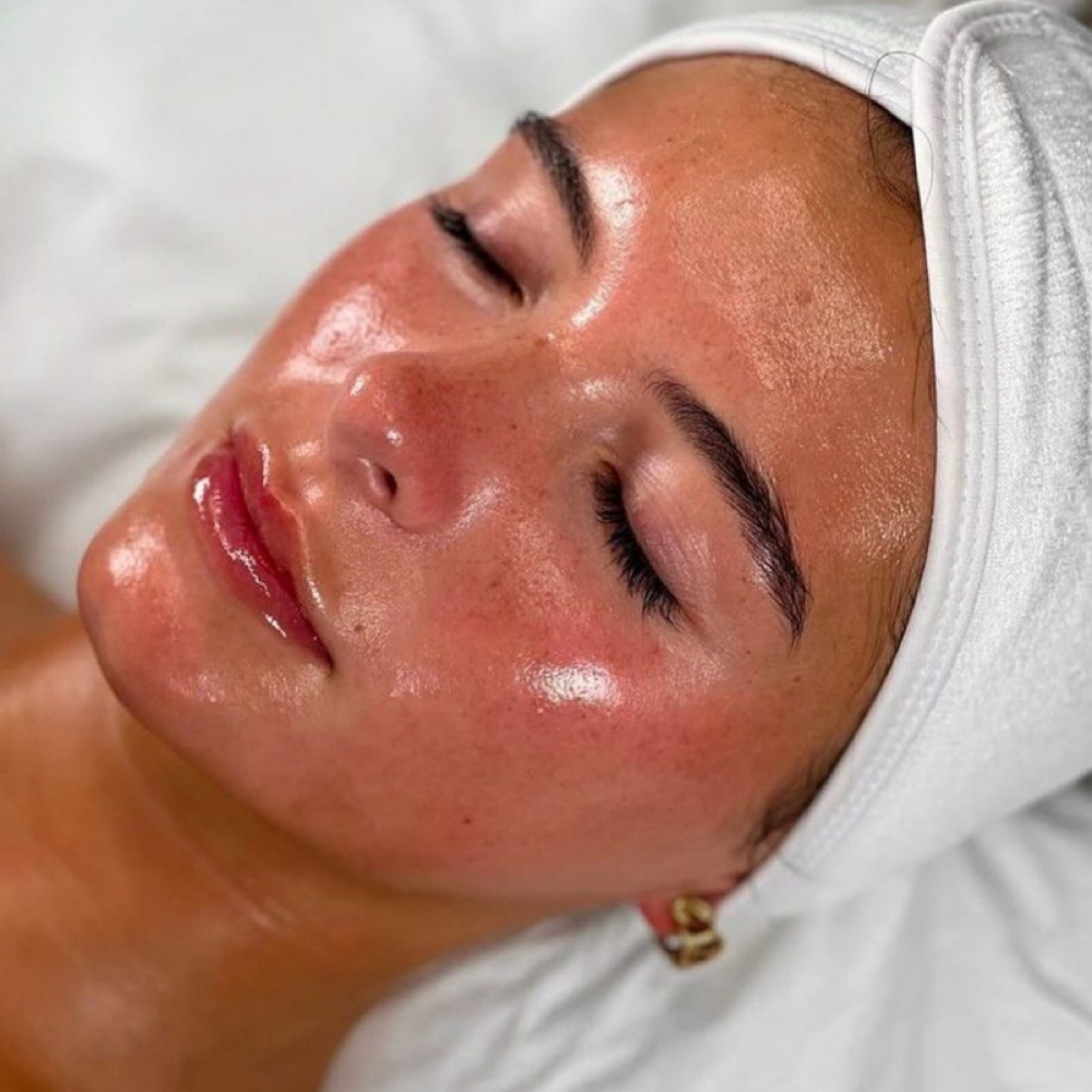 Microneedling PDRN Or Exosome at Nather Skin in Hoboken, NJ