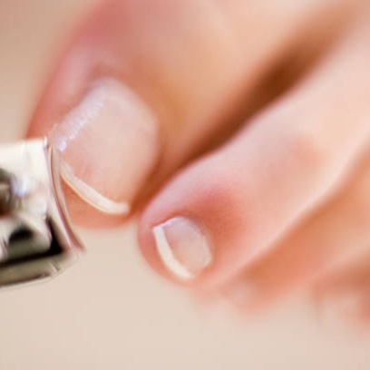 Toenail trim