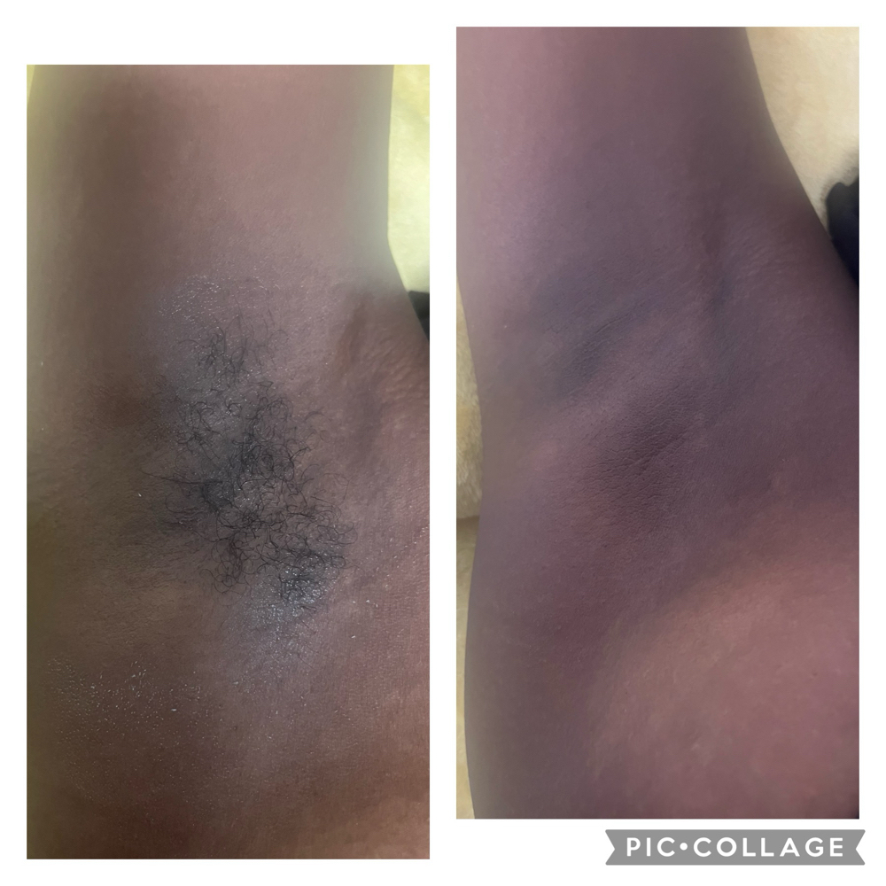 Underarm Wax