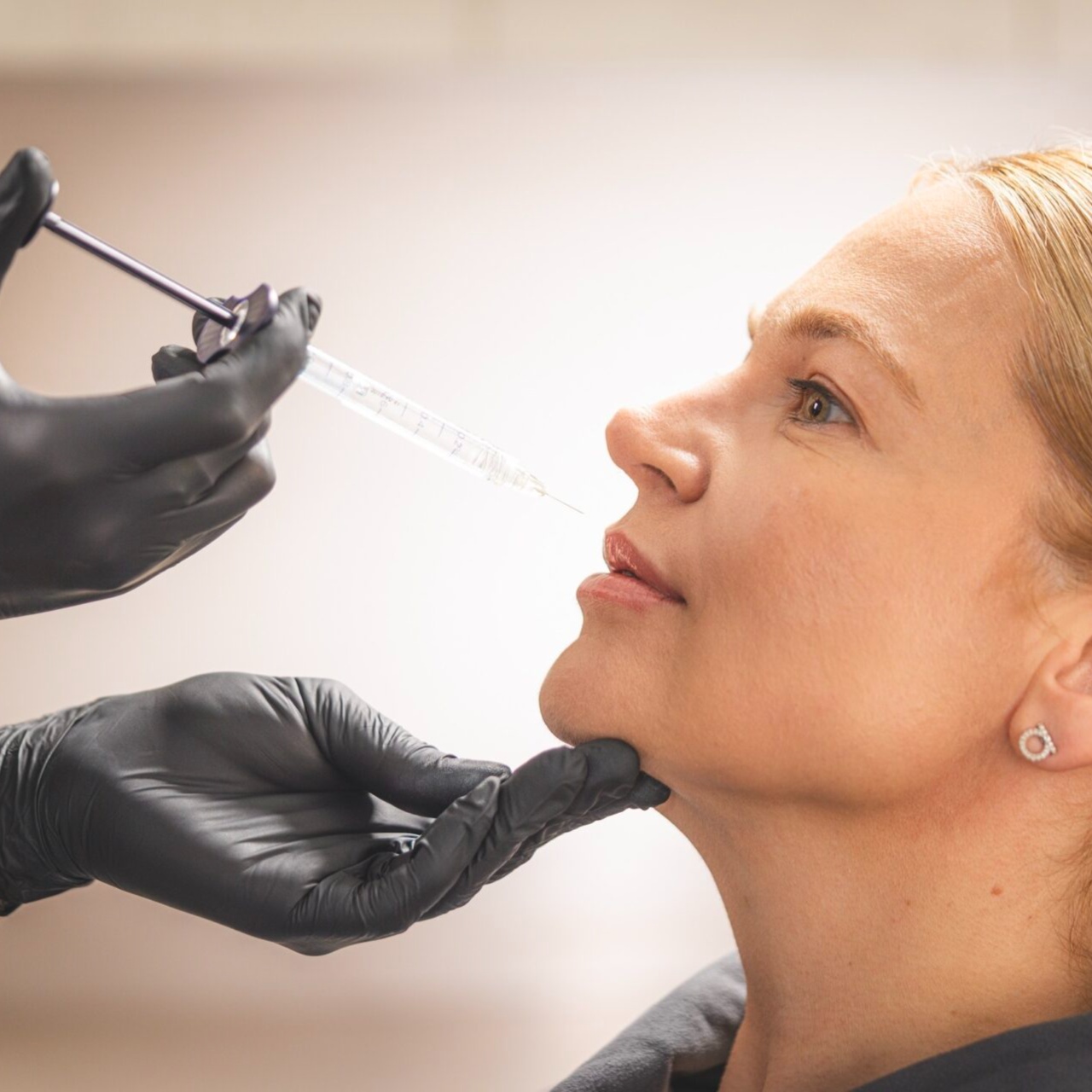 Hyaluronic Acid Filler Dissolving at RevIVeU - Bridgeport in Bridgeport, WV