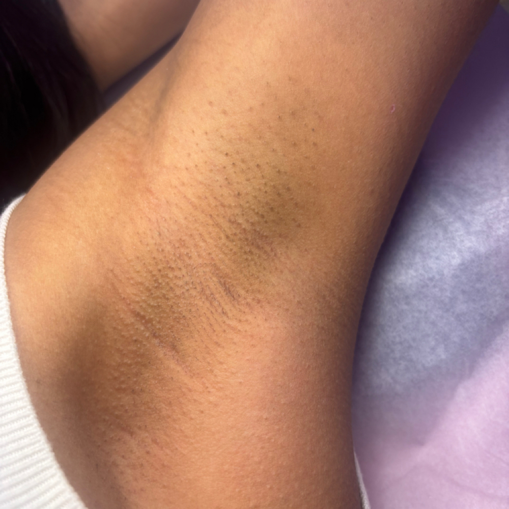 Underarm at Wax N Glow LLC in Raleigh, NC