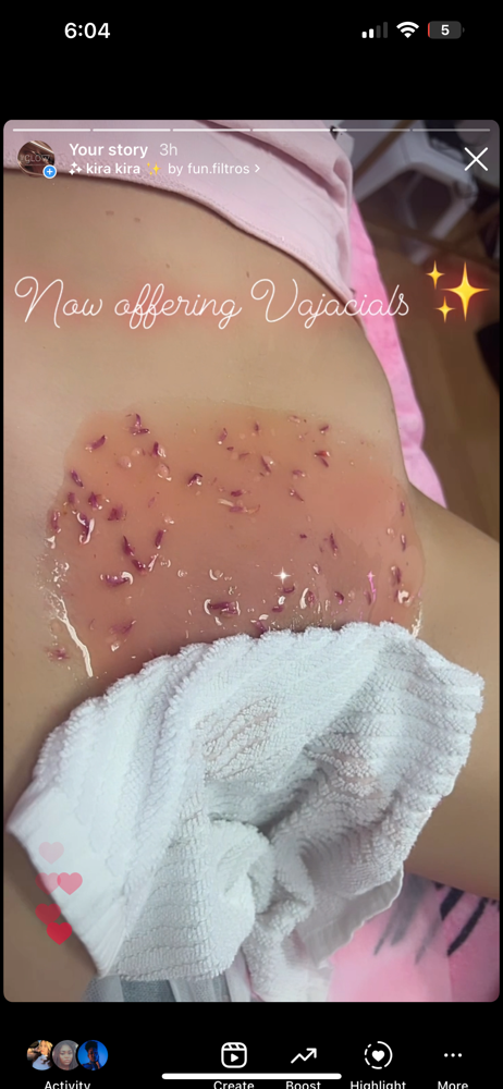 Vajacials