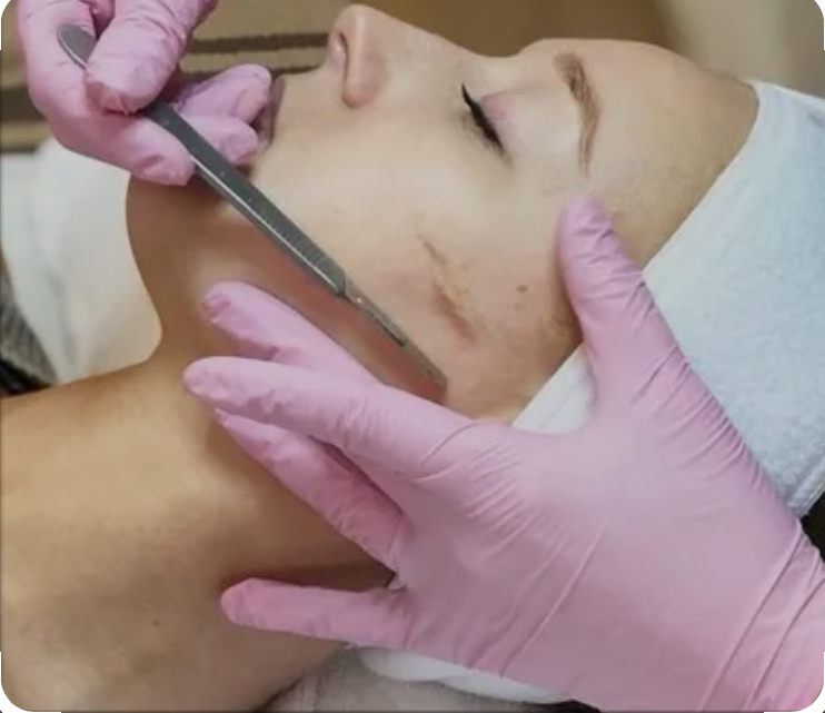 Dermaplane Add on
