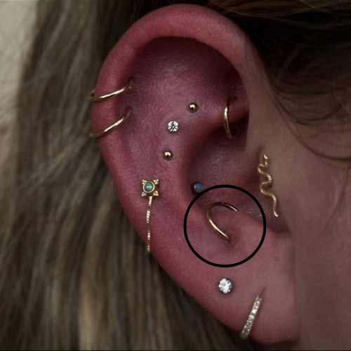 Anti-Tragus