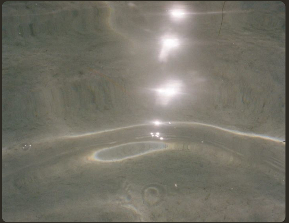 Linder Health Back Peel-add on