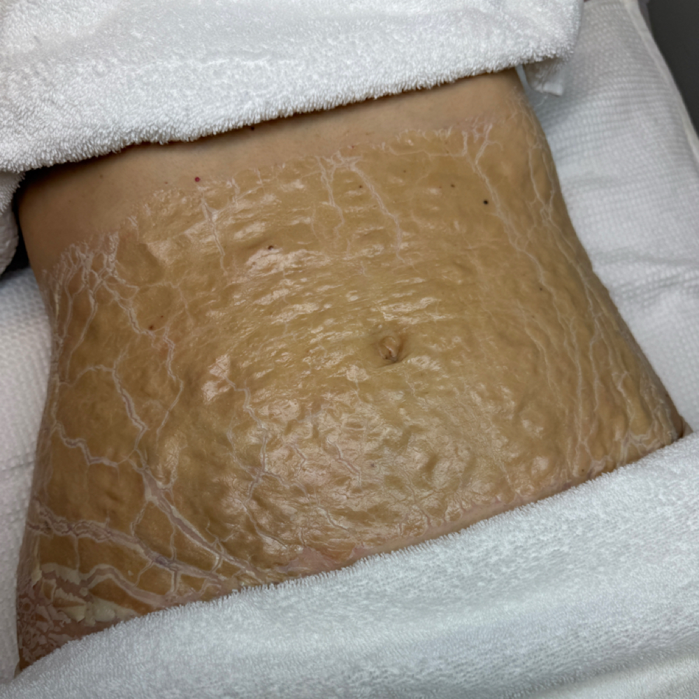 DMK Enzyme Body at Grace Esthetic in Buffalo grove, IL