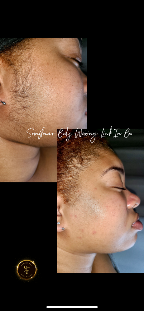 Dermaplaning Facial