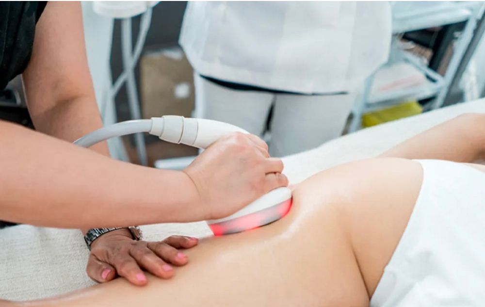 Cellulite Ultrasonic Cavitation