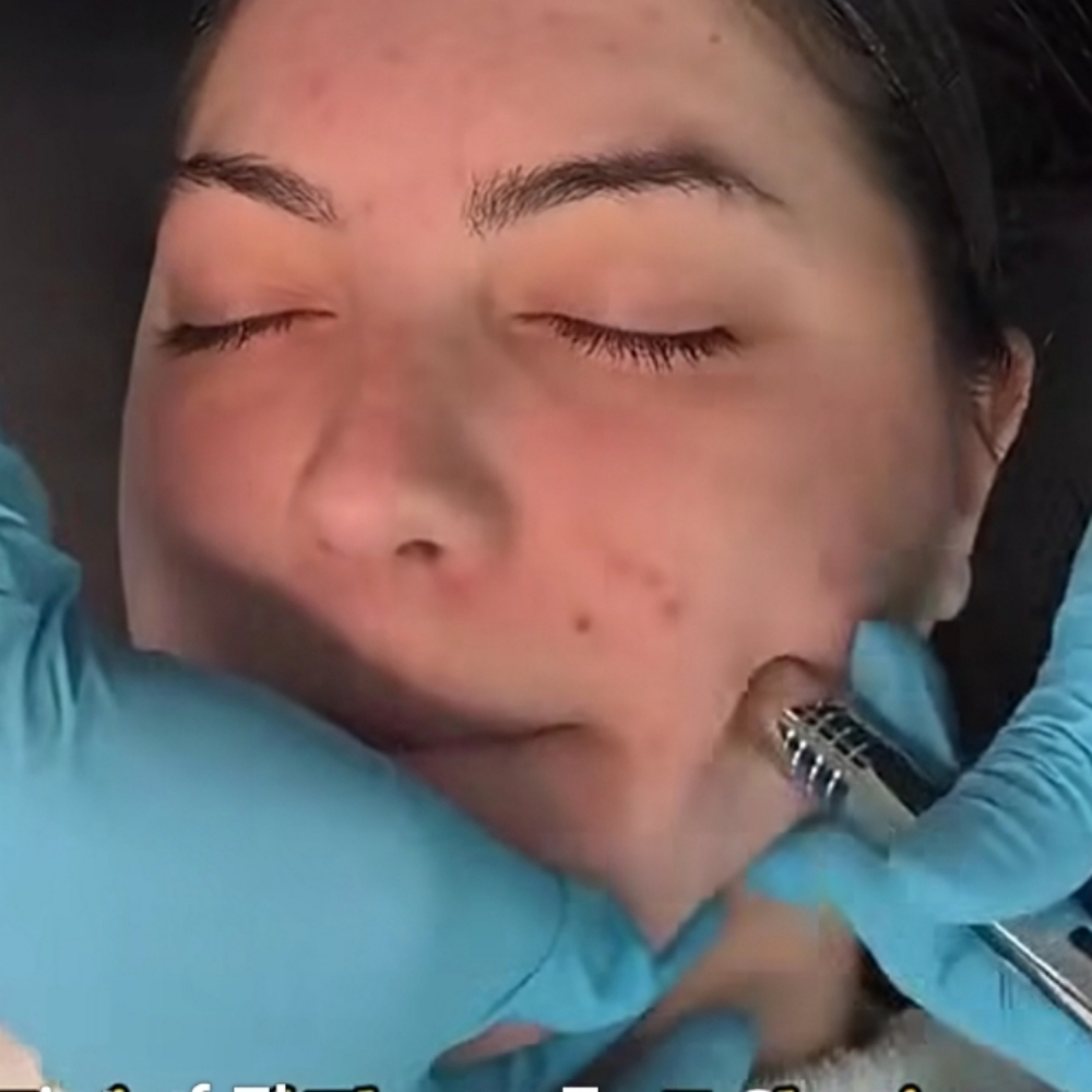 The Diamond Facial at Twistykinks & Twist of Elegance Esthetics in Jacksonville, AR