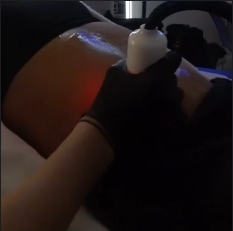 🍁 $169 Cryo Body Session
