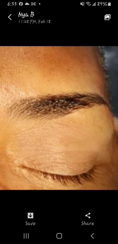 Hair Removal