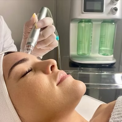 Hydro Glow Facial at Spa Ravine Med Aesthetics in wayne, NJ