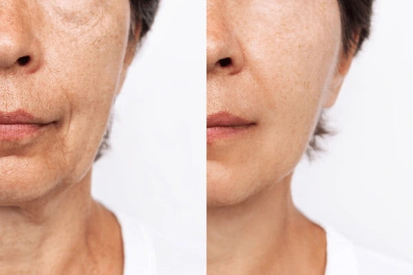 Ageless Beauty (Anti Aging Facial)