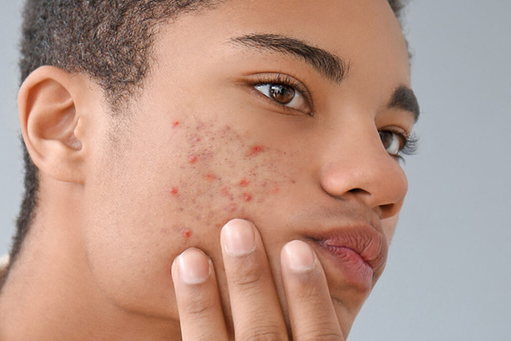 Teen Cocoa + Oxygen Facial