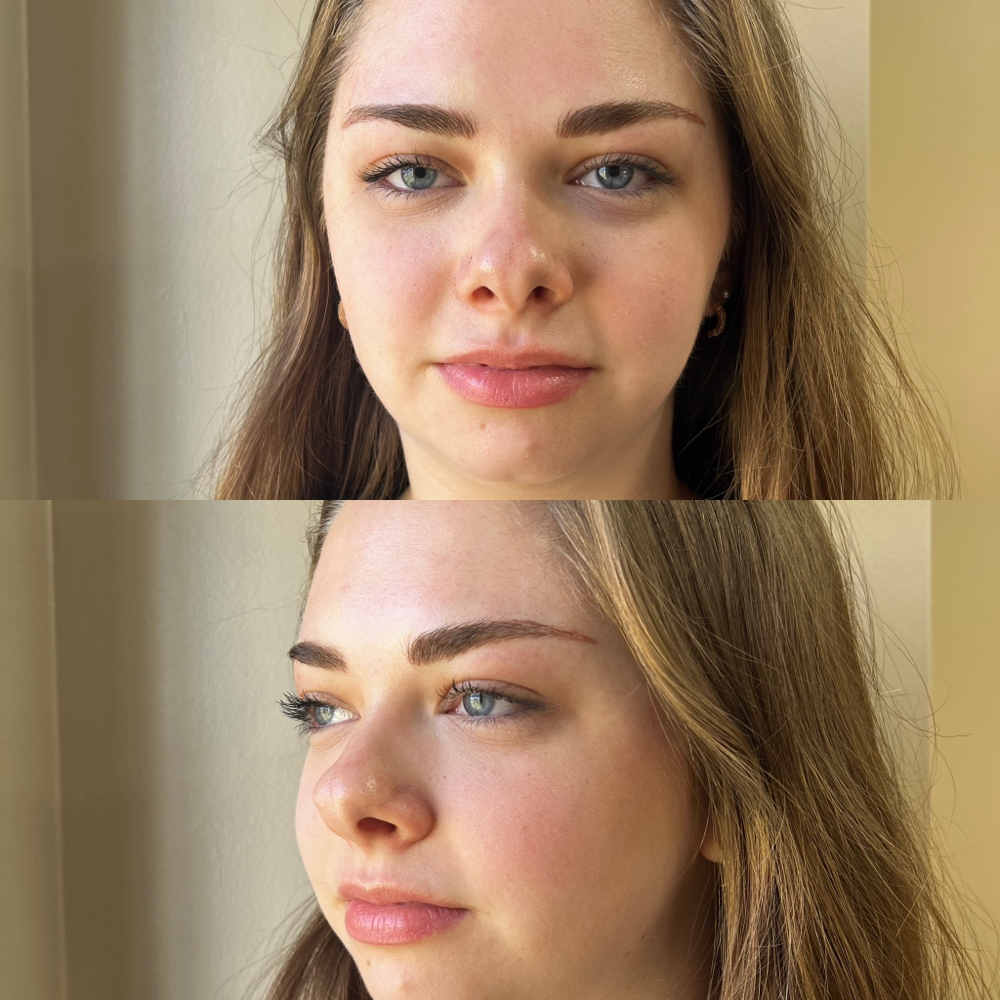 8-10 Week Touchup