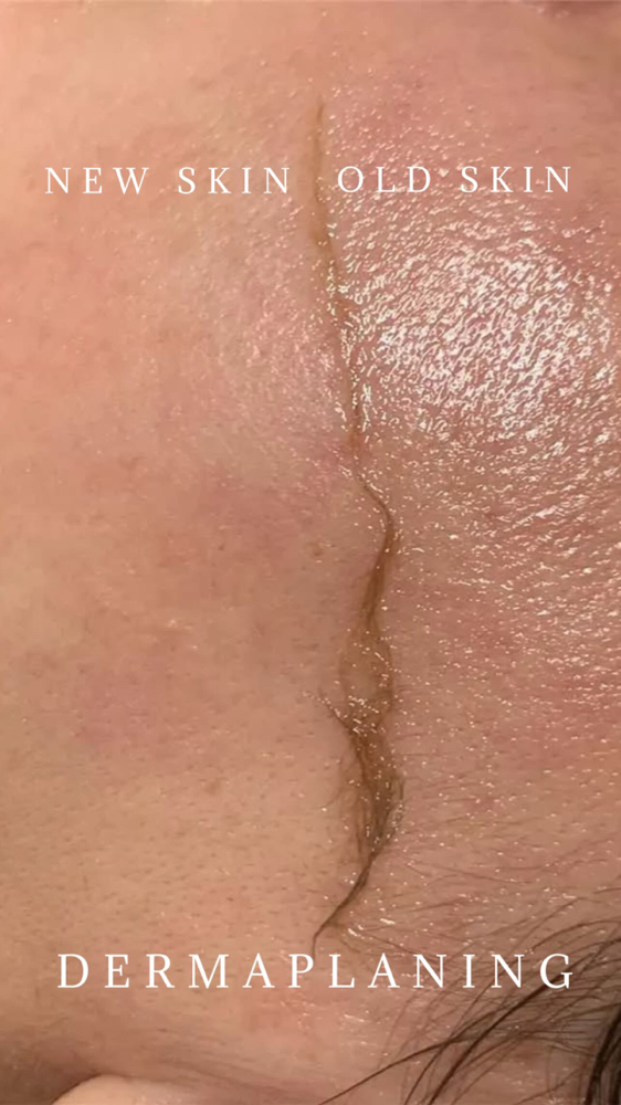 Derma ADD ON