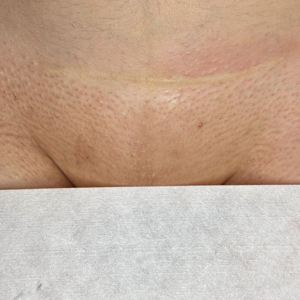 Brazilian Wax at Dania's Dominican Beauty Salon in Hicksville, NY