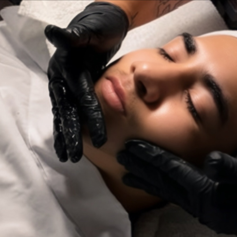 Acne Clarifying + Balancing Facial at Uncommon Esthetics in Rancho Cucamonga, CA