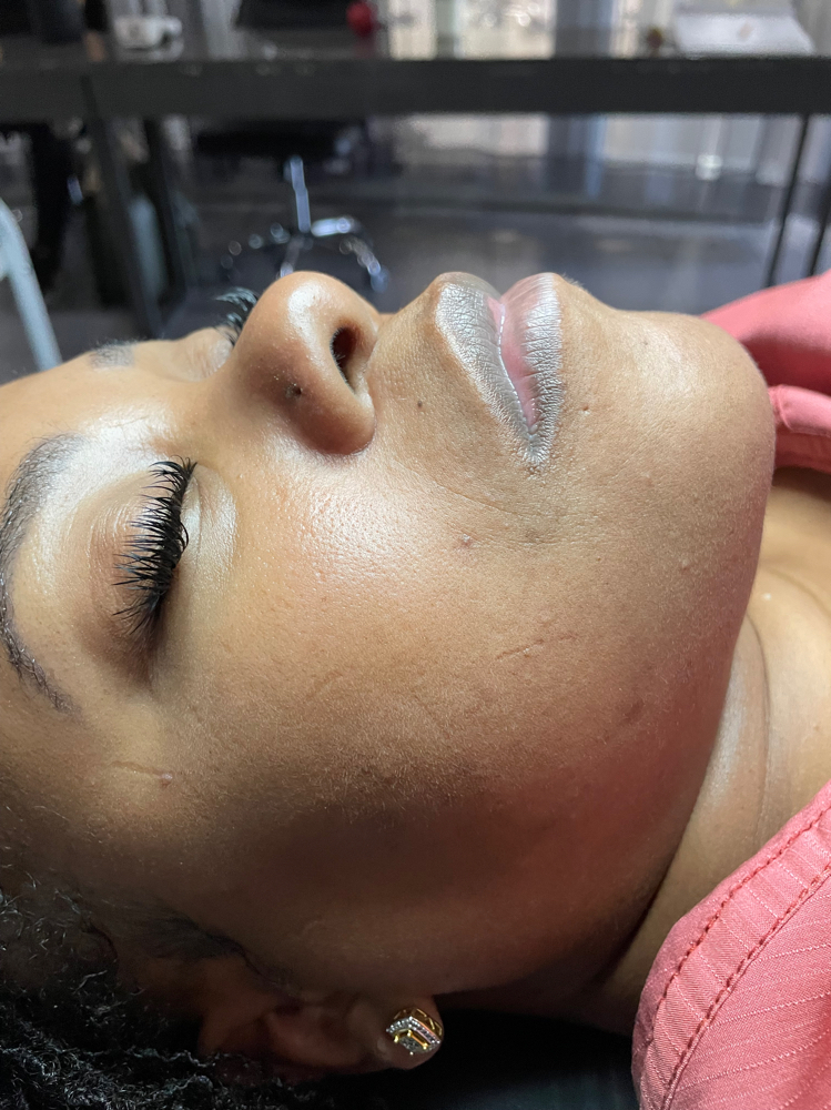 So Smooth Dermaplane