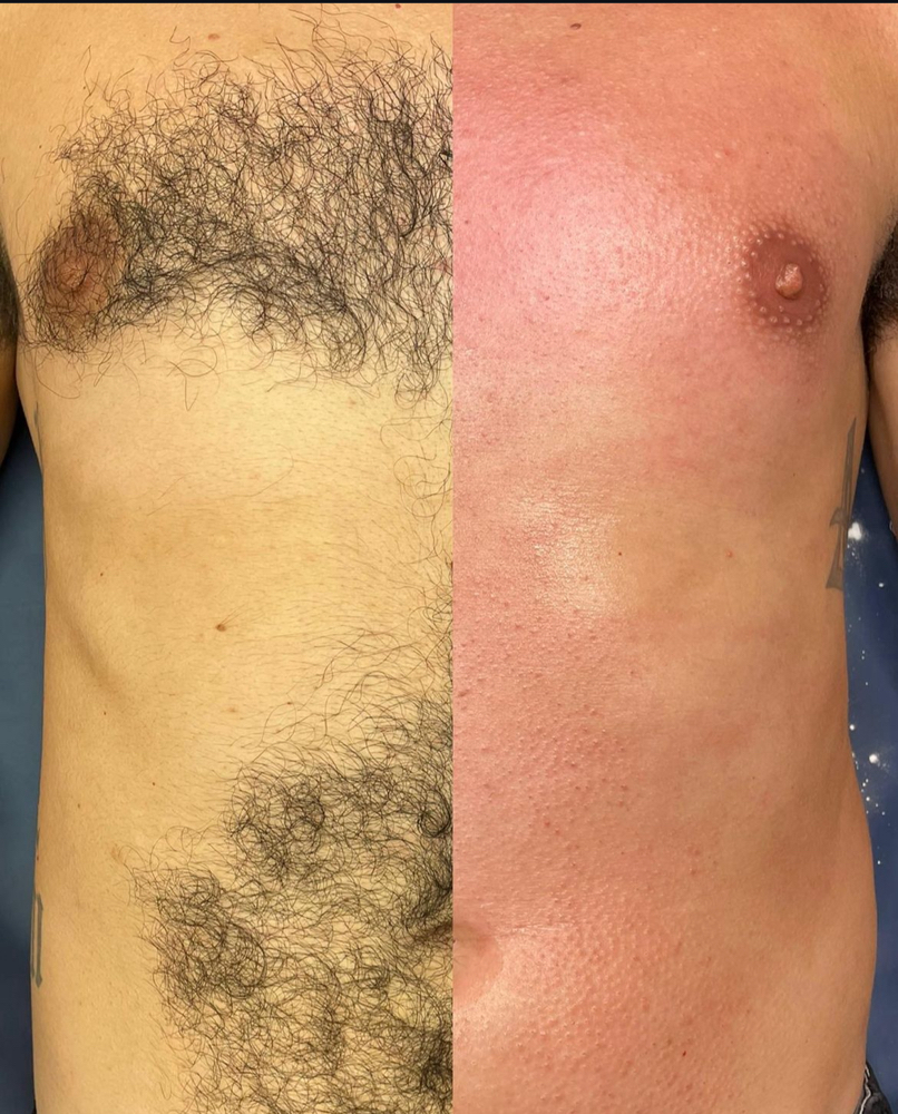 Chest & Stomach Wax at Allure Beauty Studios by Jeila in Abilene, TX