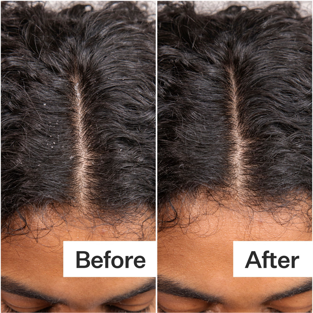 “Hydro-Sleek” Scalp Quench at Pressed by Celeste in Frisco, TX