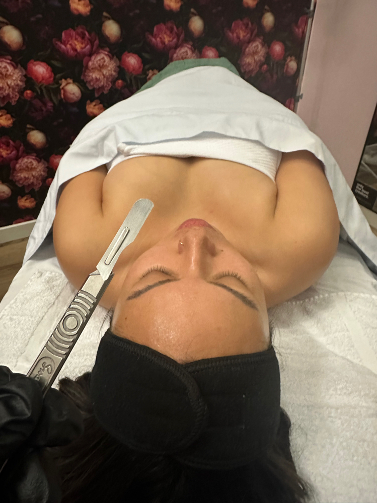 Dermaplaning Facial at Angelic Esthetics LLC in Waterloo, NY