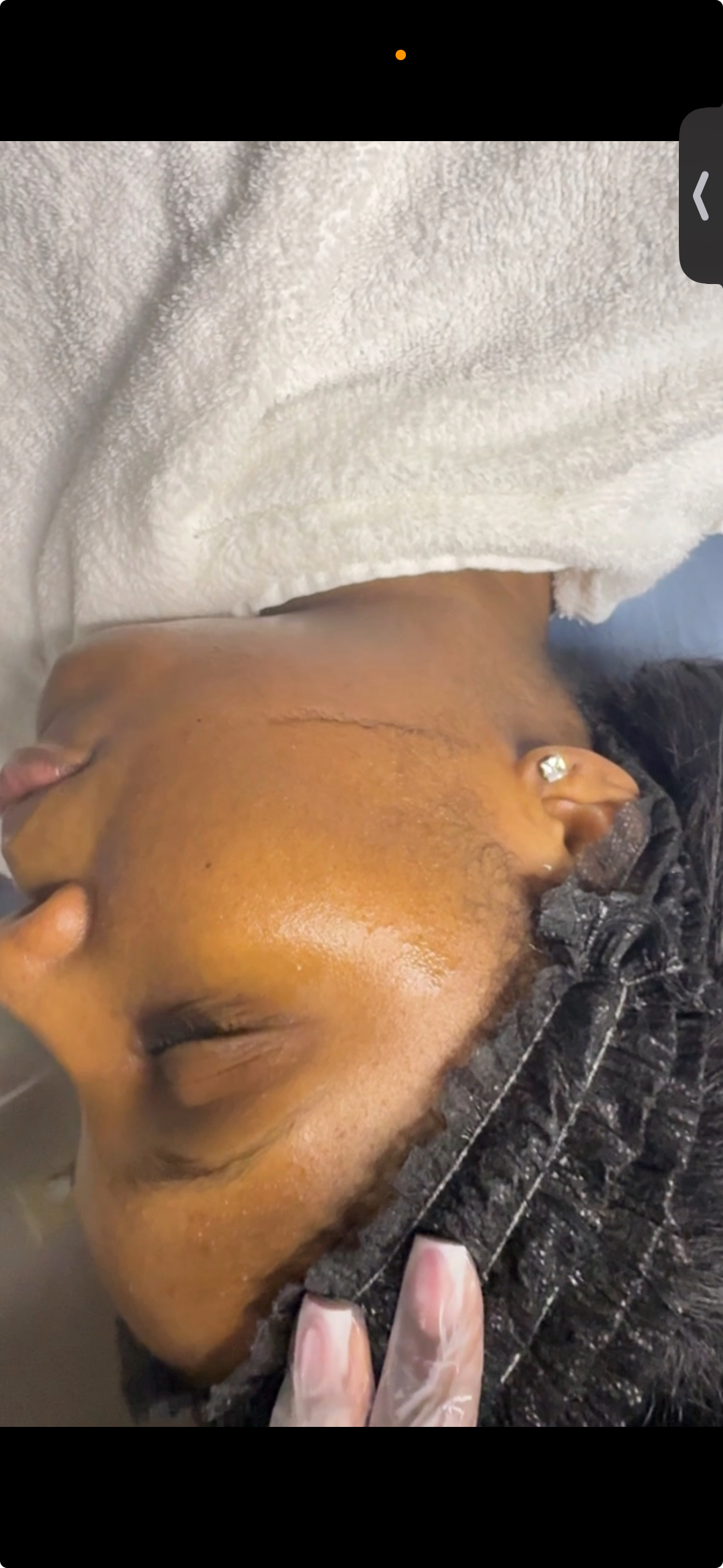 Dermaplane Facial