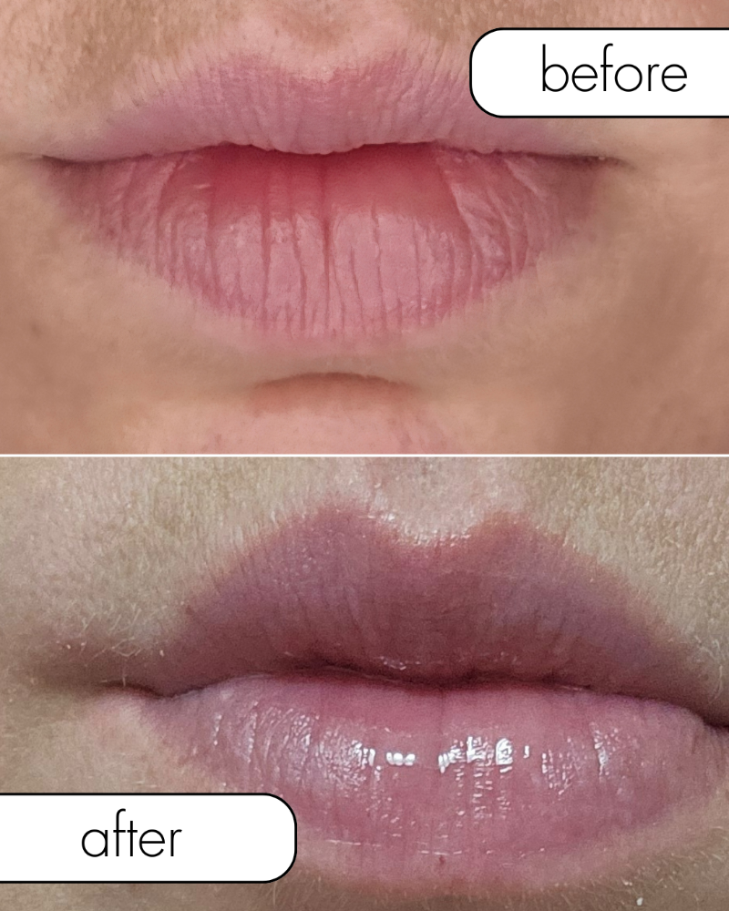 Hydragloss Lip Plumping