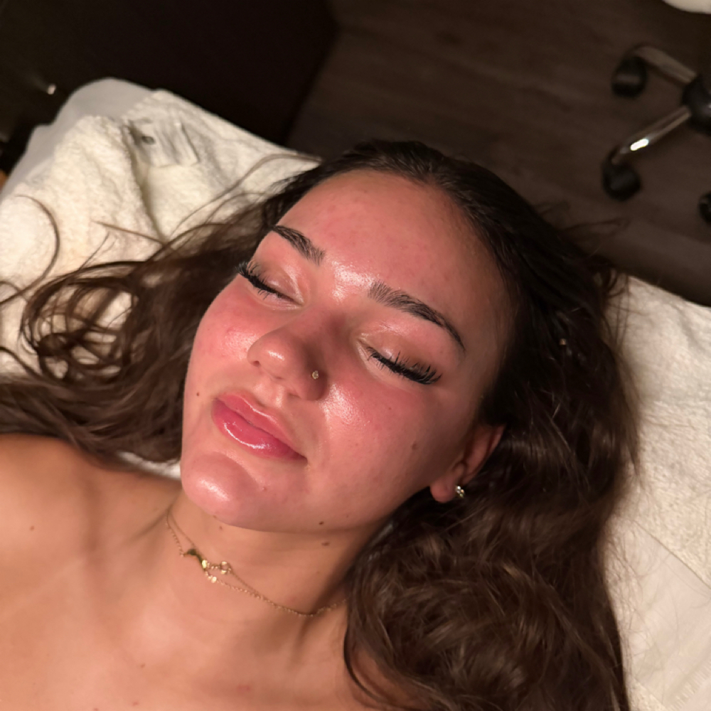 Complexion Reset at Glow By Emma in Schererville, IN