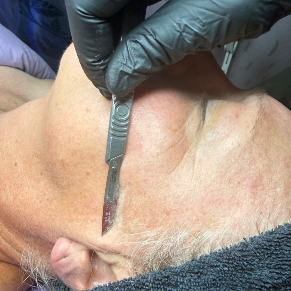 Dermaplane Only Facial at Alpenglow Esthetics in Nederland, CO