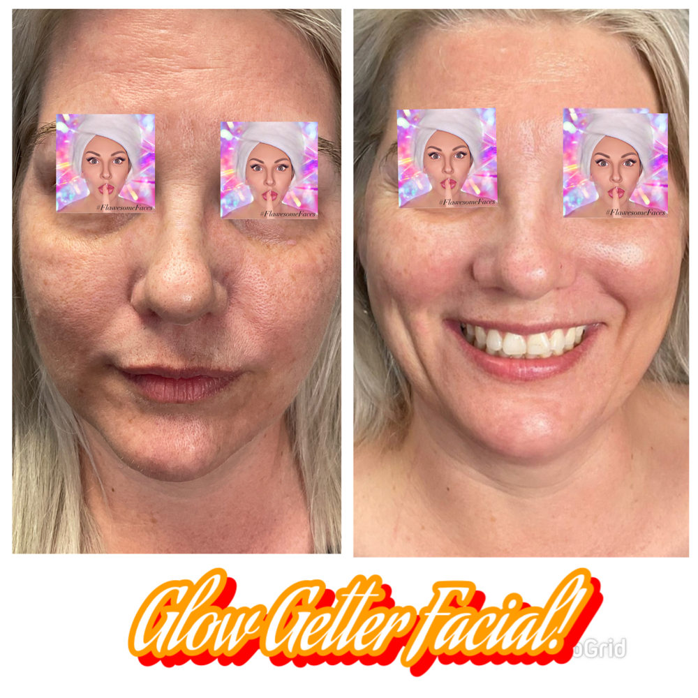 Glow Getter Facial