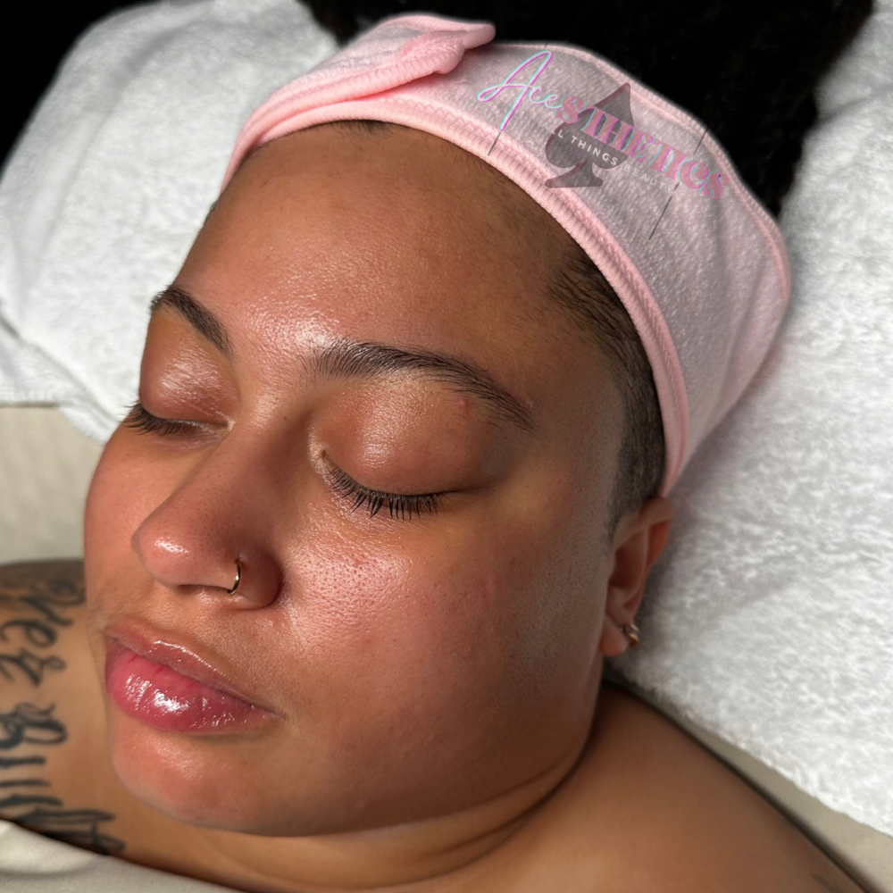 ACE Luxury Facial ✨ at ACESTHETICS LLC in Milford, CT