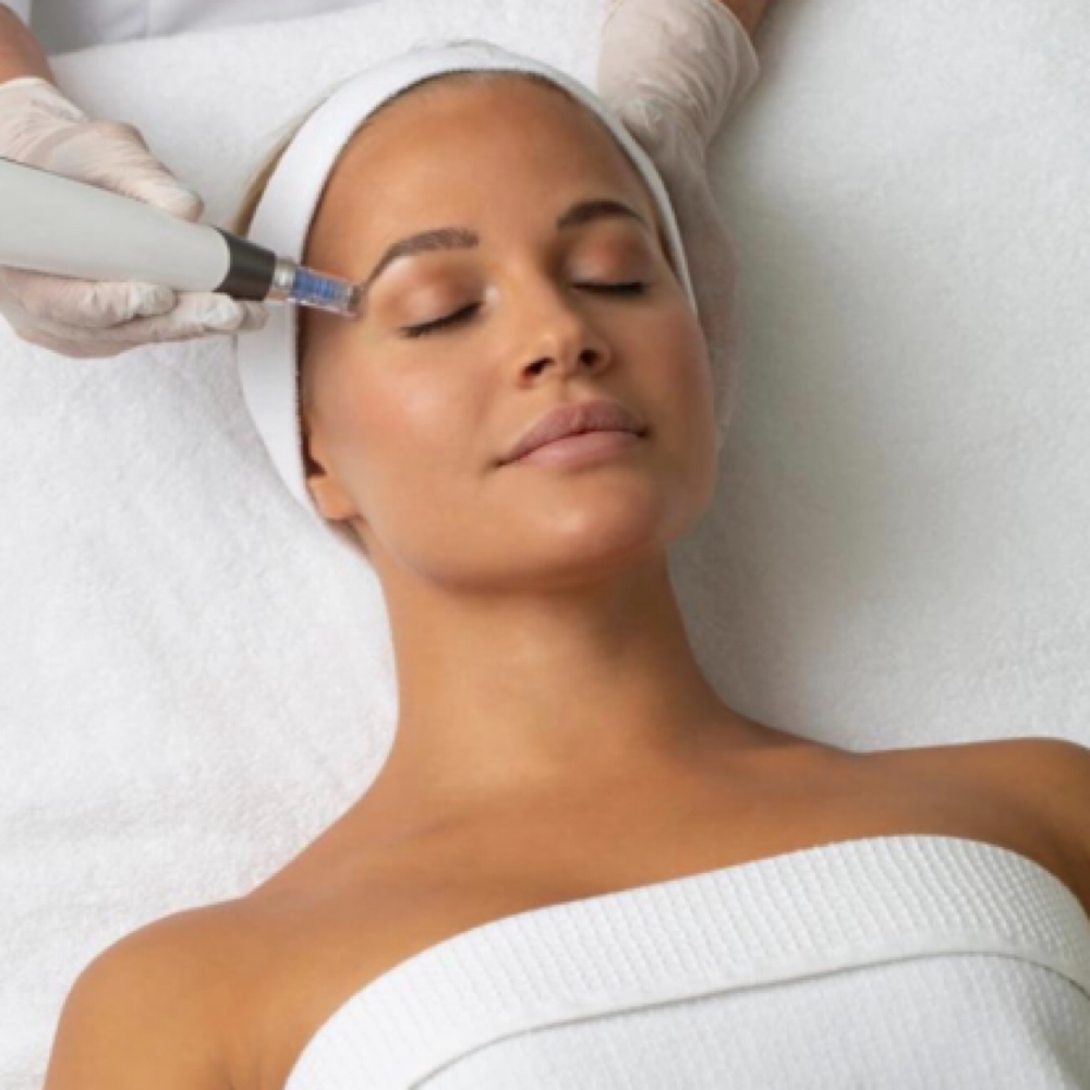 Microneedling at Sunshine Esthetics Lounge in Lake Mary, FL