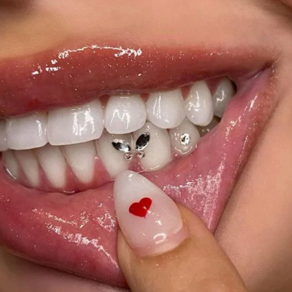 Teeth Gems at The Hideaway in Standish, MI