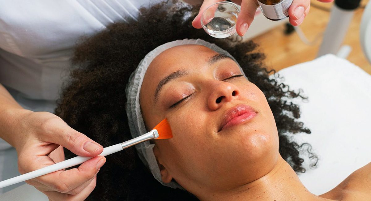 Newbie Peel –  Gentle Introduction