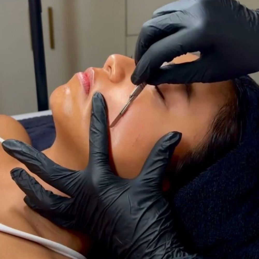 Dermaplaning at Black Cactus Body Bar & Boutique in Mount Juliet, TN