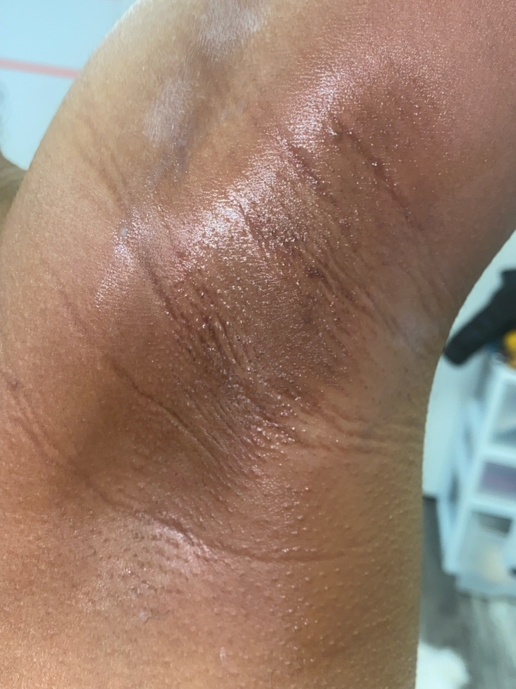 Under Arm Wax at Deasia Brewer in Chattanooga, TN