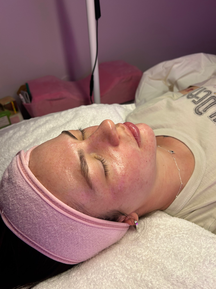 Dermaplane Facial