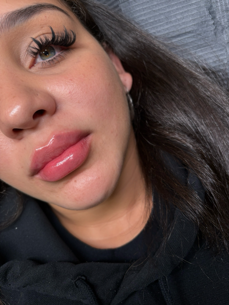 Lip Filler & lashes