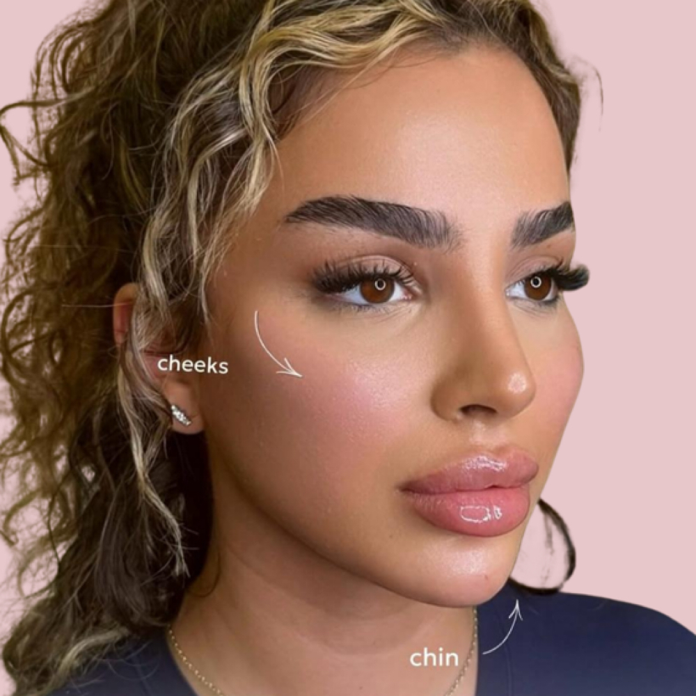 Lip Filler & Lashes at Aesthetics by Amina in New York, NY