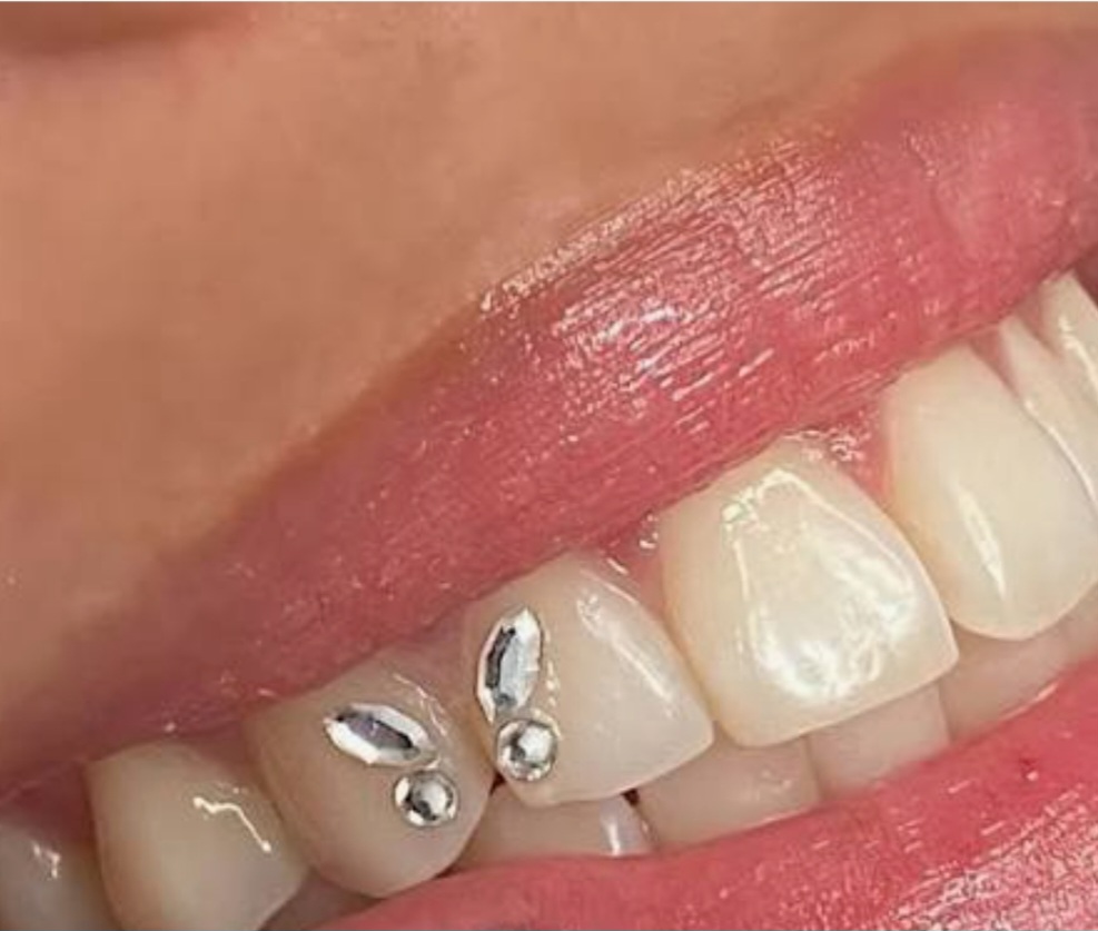 Swarovski Butterfly Tooth Gem