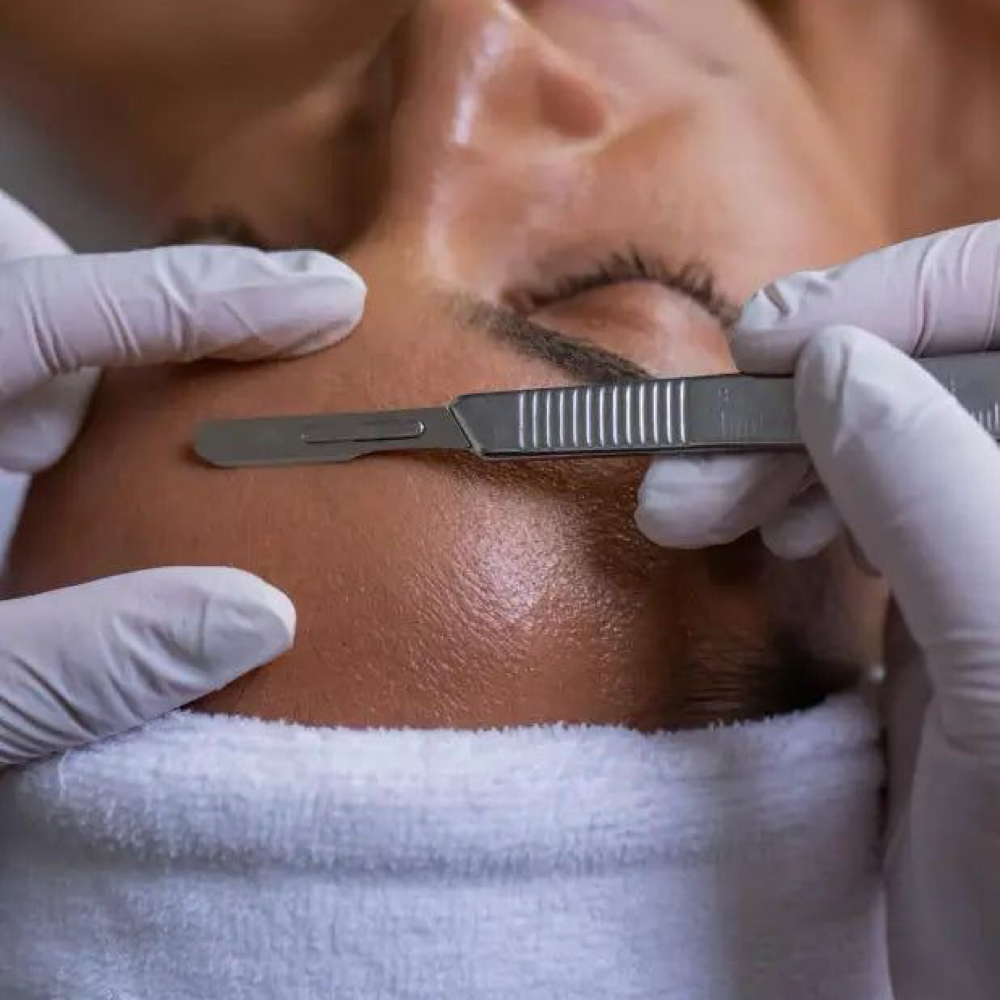Dermaplaning at BEAM LASER STUDIO in Plymouth, MI