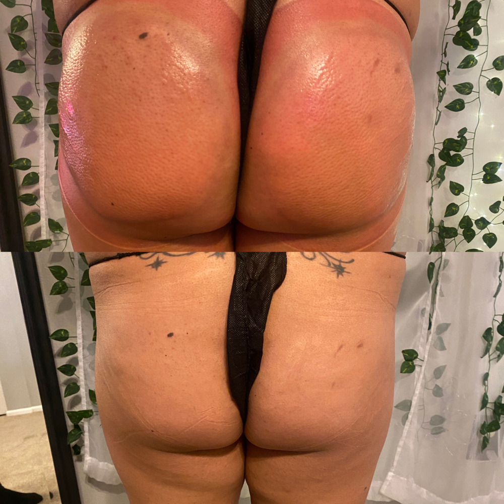 Butt Fillers 70ml