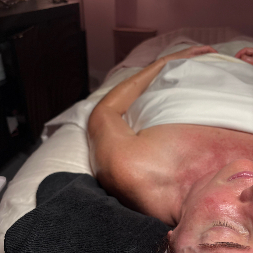 Mandelic & Ferulic Peel at Simple Skin With Madison in Omaha, NE