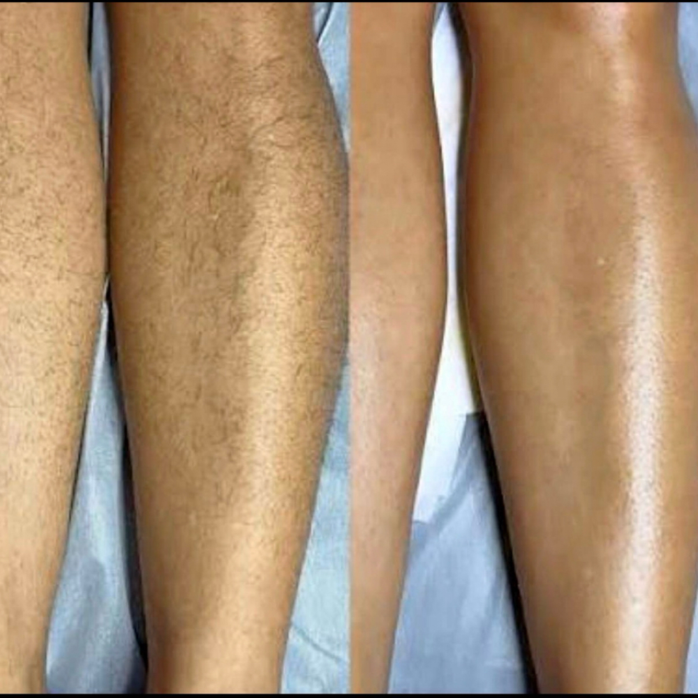 Lower Leg at Belladz Wax Studio in Beltsville, MD