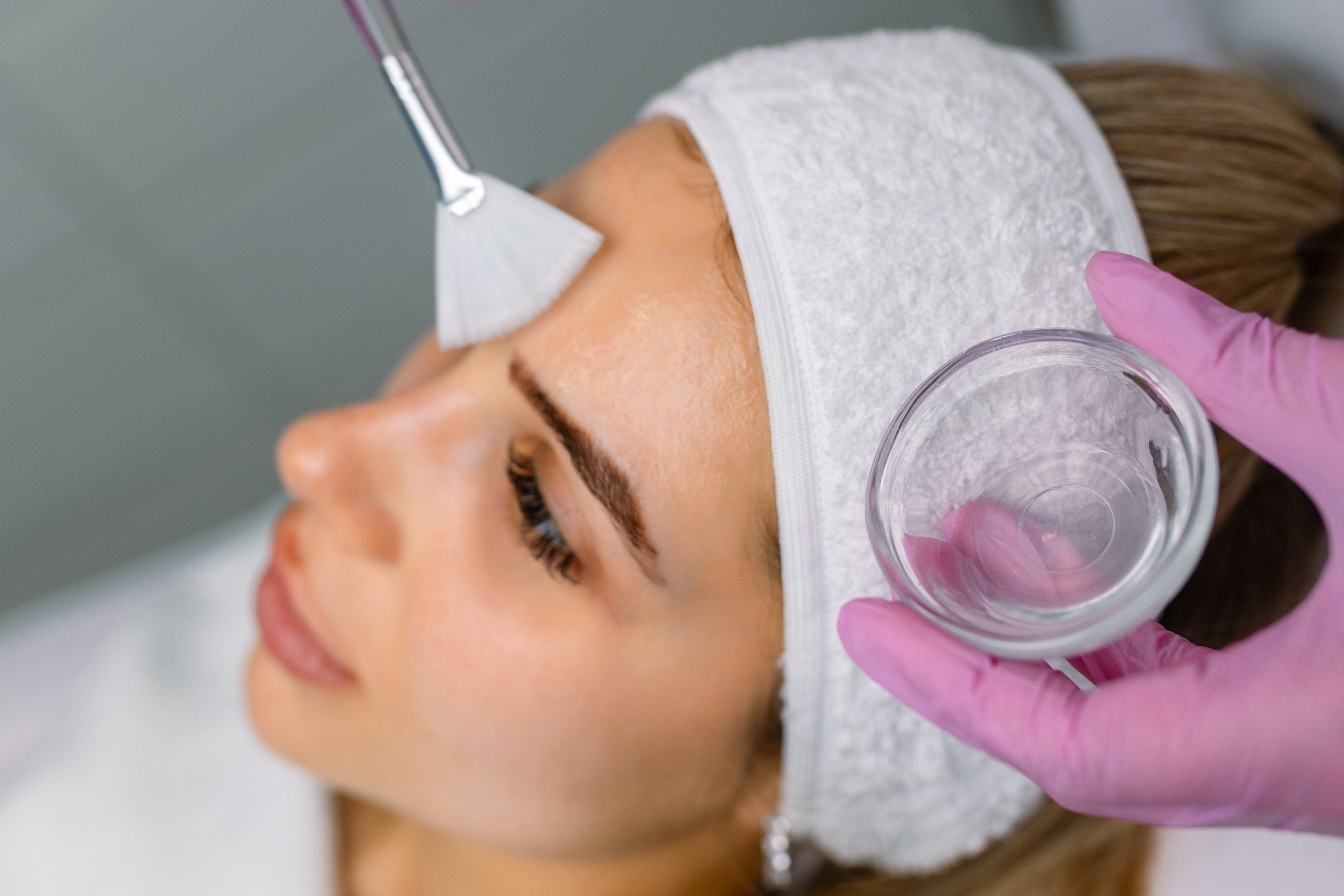 Chemical Peel- Level 1