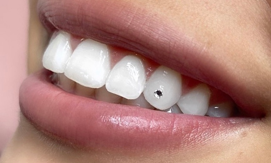 SWAROVSKI TOOTH GEM OPTIONS