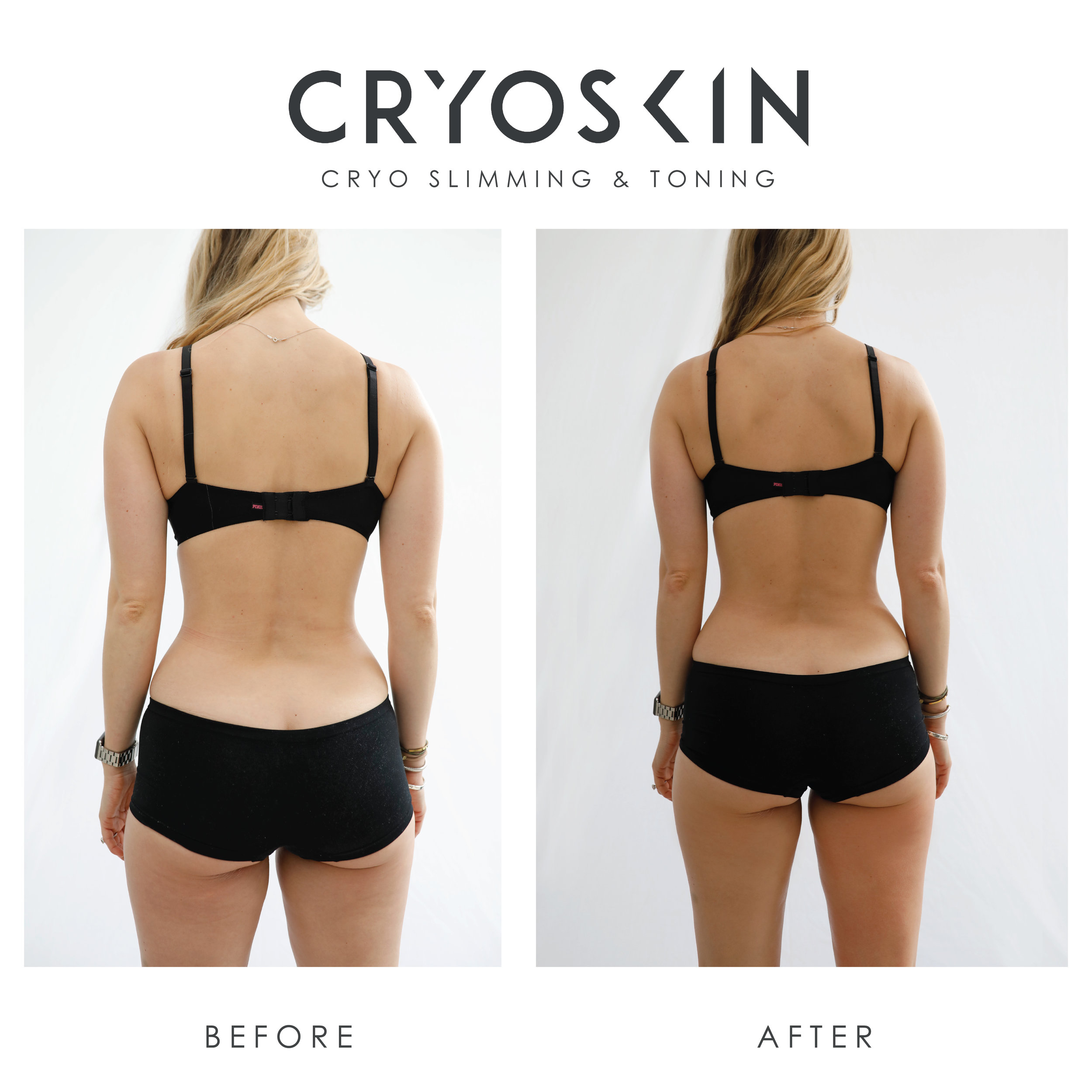 CryoskinToning Men/Women Body